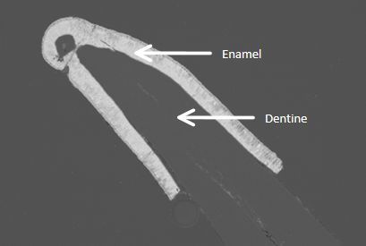   Scanning electron microscope image showing the tooth structure